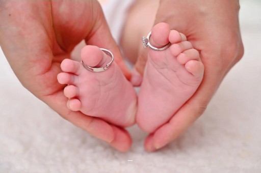 国内正规代孕同志肚子上长妊娠纹